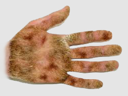 hairyhand
