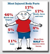 Brandon Keith fell into the 17% of kids with eye injuries ...